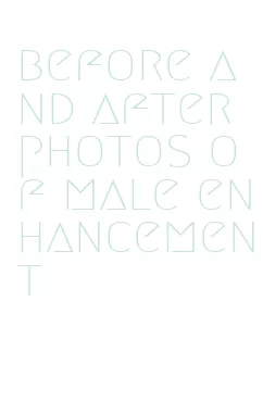 before and after photos of male enhancement