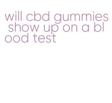 will cbd gummies show up on a blood test