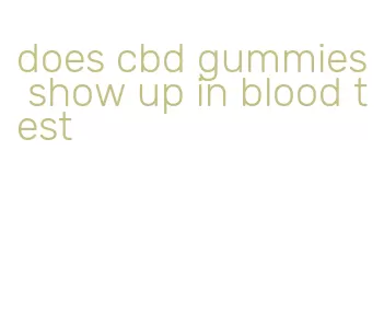 does cbd gummies show up in blood test