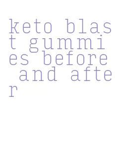 keto blast gummies before and after